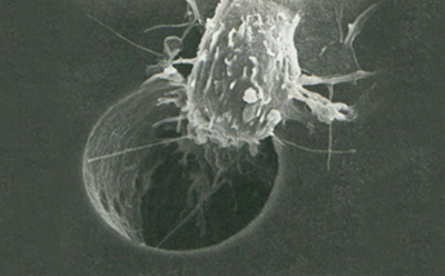 پیشرفت های چشمگیر در درمان سرطان پیشرفت های چشمگیر در درمان سرطان